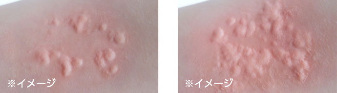 症状