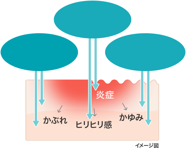 イメージ図