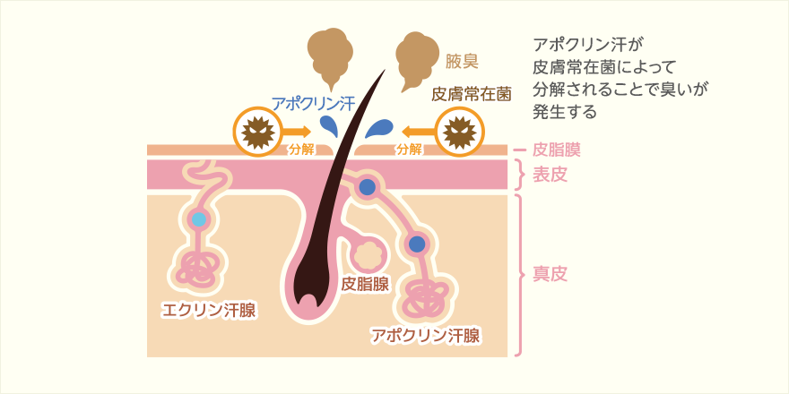 ワキガの仕組み