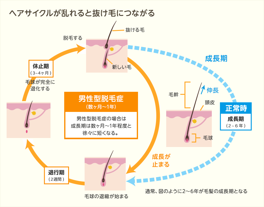 正常の毛周期と、AGAの毛周期