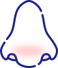 炎症がおこる