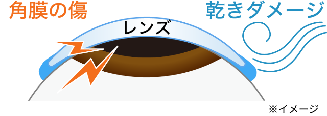 レンズ