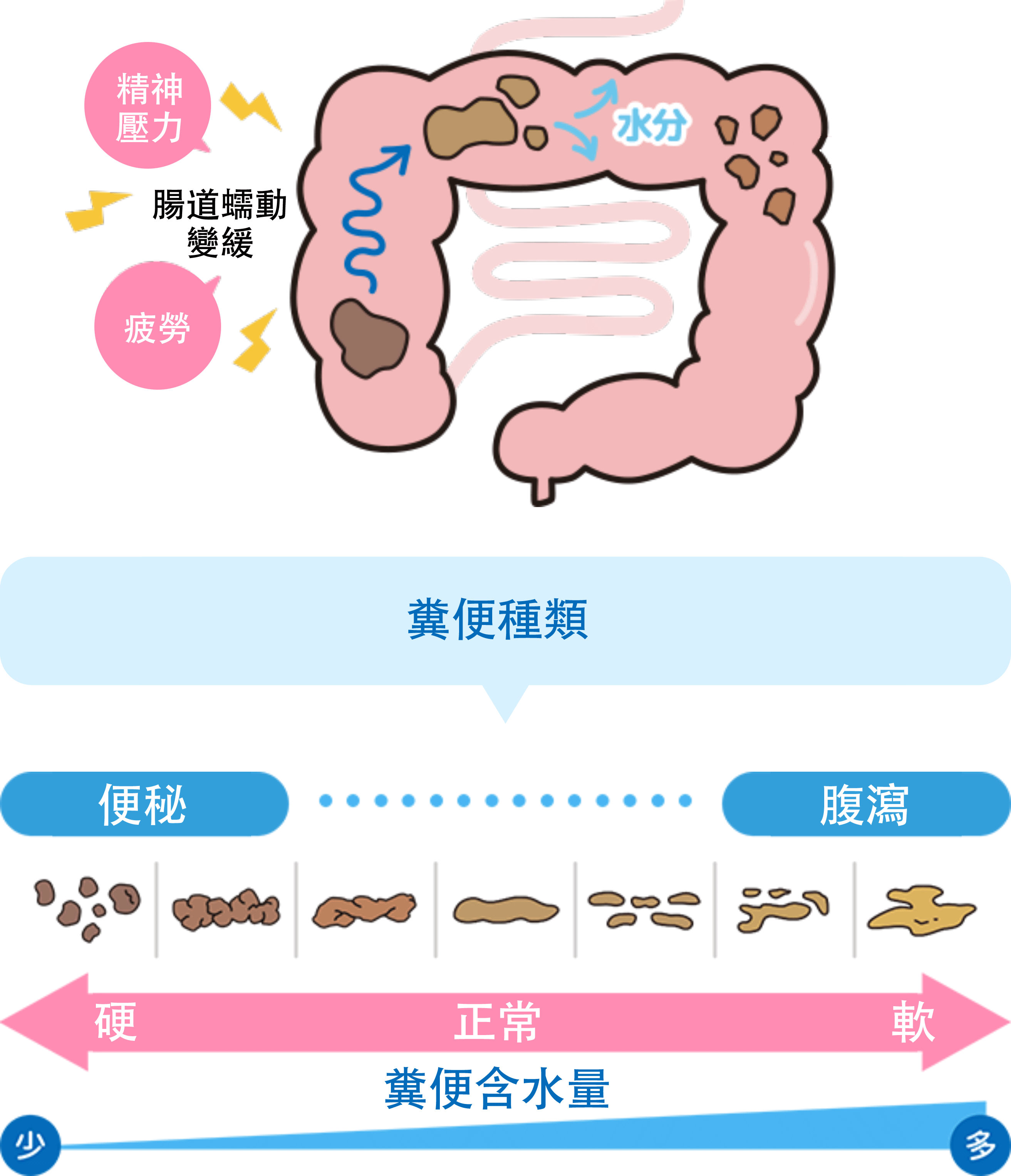 便秘成因