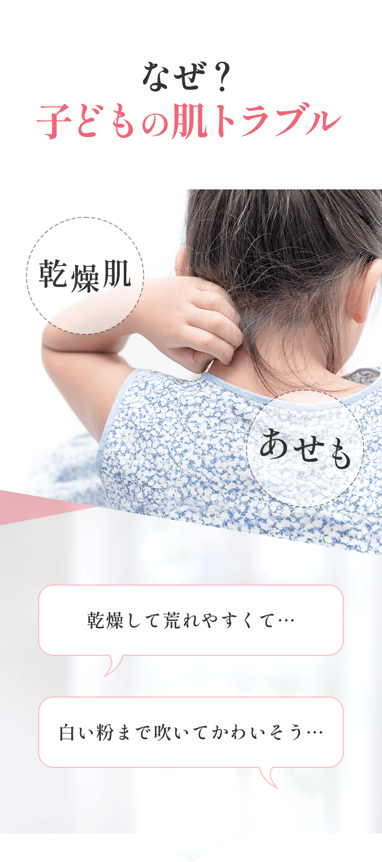 なぜ？子どもの肌トラブル 乾燥して荒れやすくて… 白い粉まで吹いてかわいそう… 乾燥肌 あせも